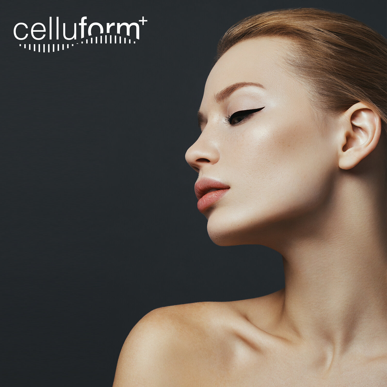 Highly effective treatment of submental fat / Double chin